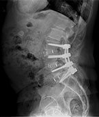 Patient Cases After pic